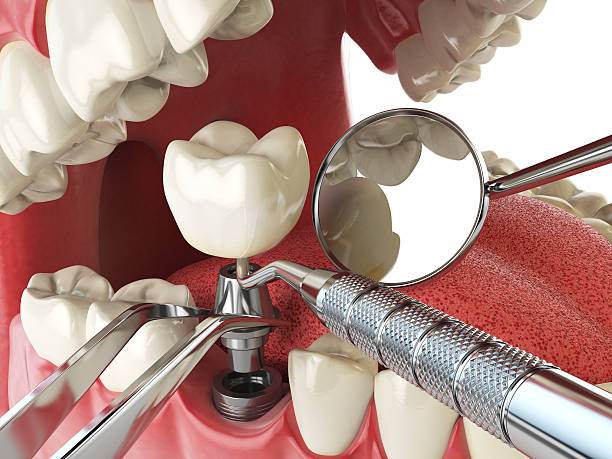 Best Emergency Care for Gum Disease in Richland, MO